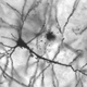 Illustration for article titled Alzheimers Patients May Someday Be Able to Regain Lost Memories